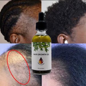 HAIR GROWTH OIL